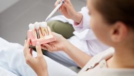 Dentist showing a model of a dental implant to a patient