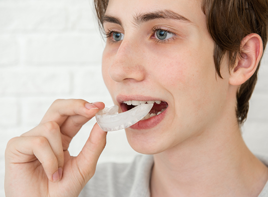 Person placing a white nightguard over their teeth