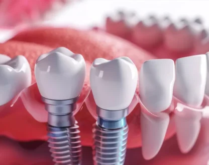 Can You Get Dental Implants During Pregnancy?